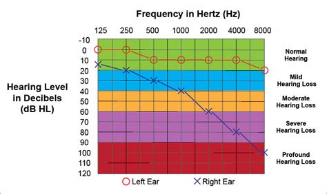 how to read speech audiometry results|Speech Audiometry: An Introduction .